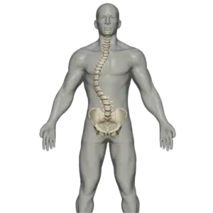 Escoliose
